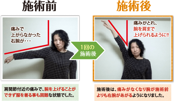 img--00026.png